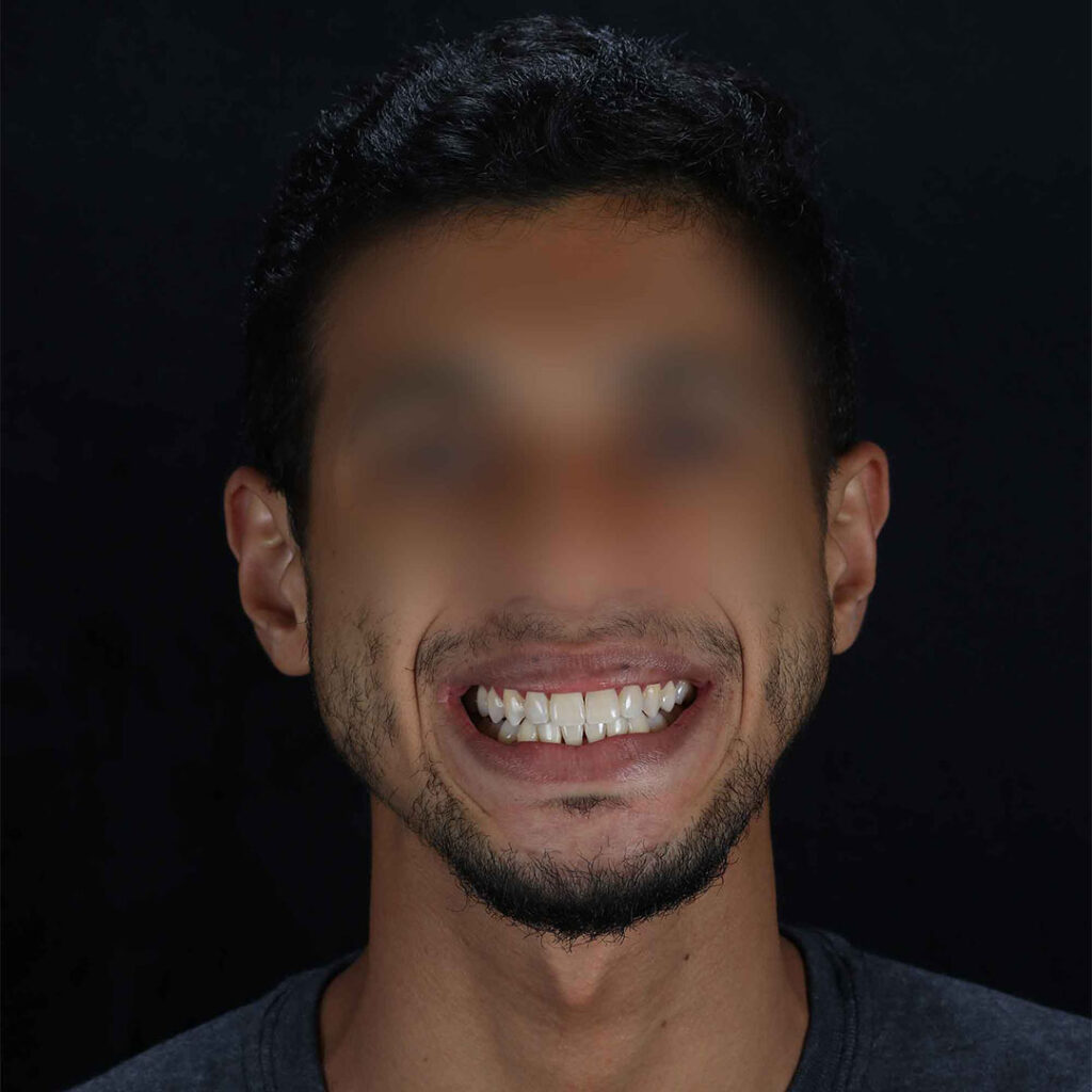 Cirurgia Ortognática em Belo Horizonte